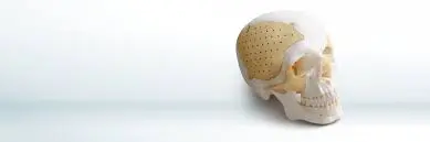 Recranio™ Cranio-Maxillofacial repair system